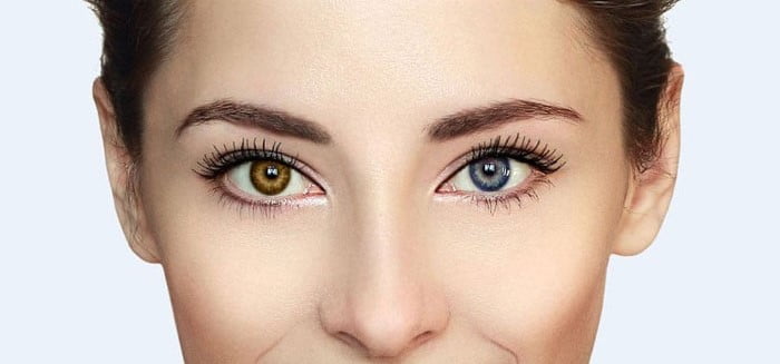 Celebrities with Heterochromia