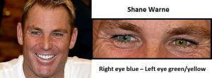 shane warne