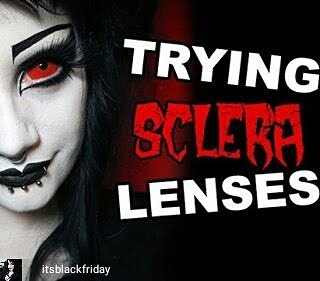 sclera