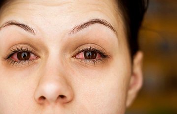 pink eye disease & contact lenses