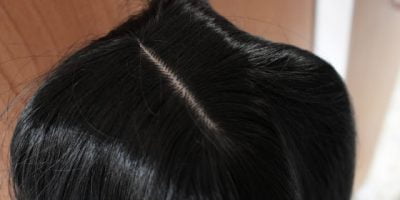 lolita wig 292 A scalp