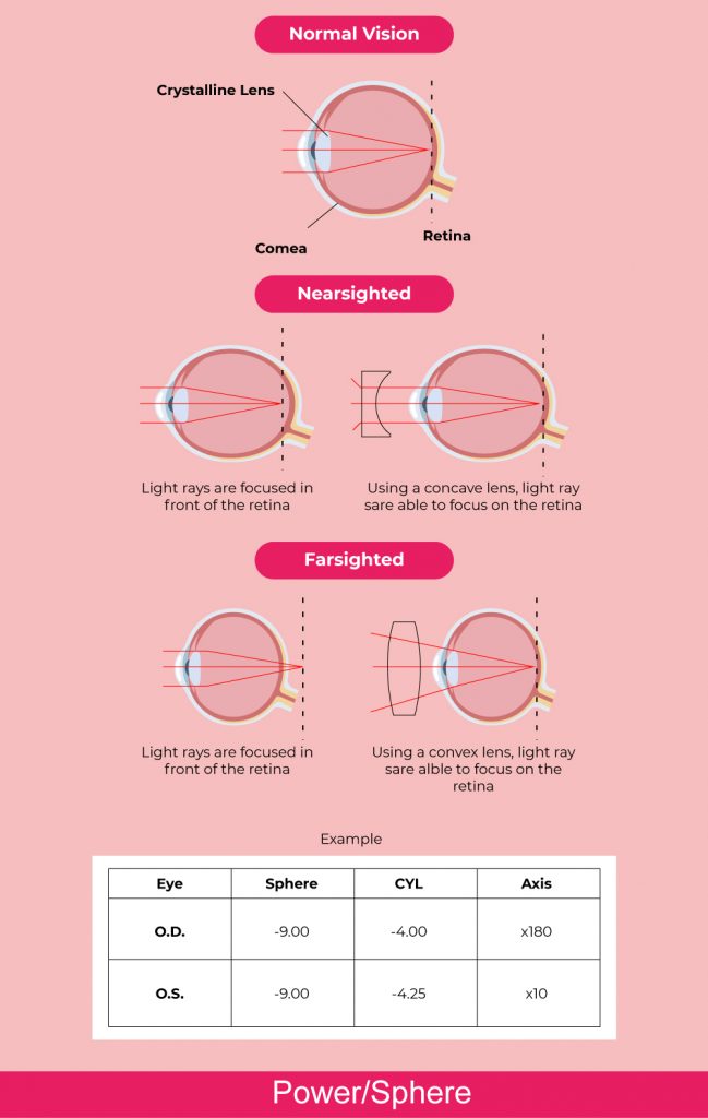 Contact Lens Prescription How To Read And Get It Right   How To Read Contact Lens Prescription 02 2 649x1024 