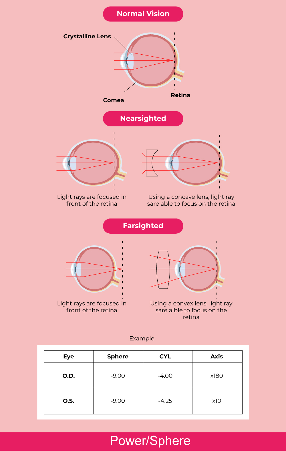 What Does Bc Stand For In Contact Lenses