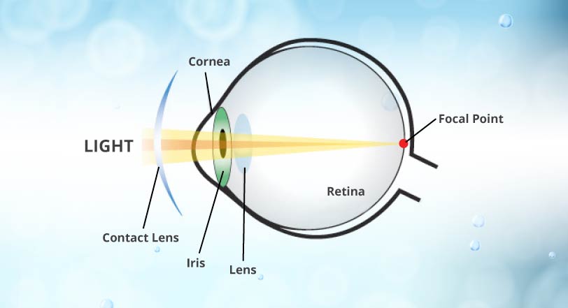 how do contact lens work