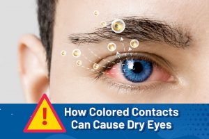 Beautiful Dry Eye From Contacts Capture Illustration