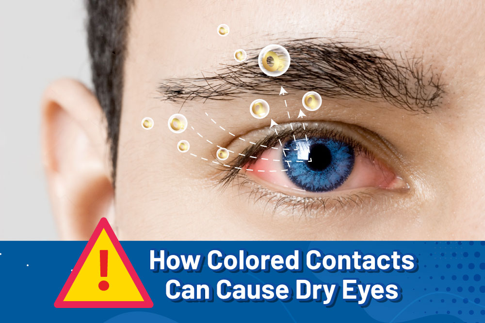 Best Colored Contact Lenses for Dry Eyes: Silicone Hydrogel Contacts