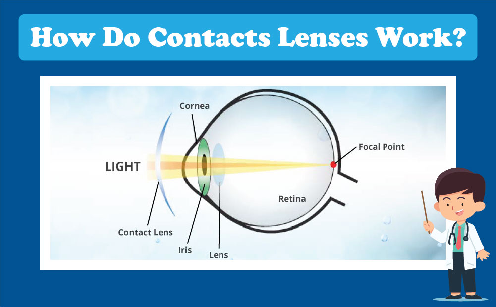 How Do Contacts Lenses Work